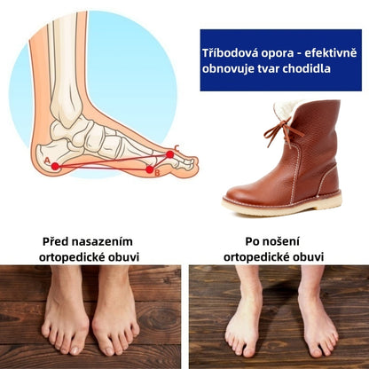 🎉 Dnešní speciál: 70% sleva - Nenechte si ujít! ⏰ Ergonomická dámská ortotická zimní obuv pro úlevu od bolesti nohou, kolen a zad.