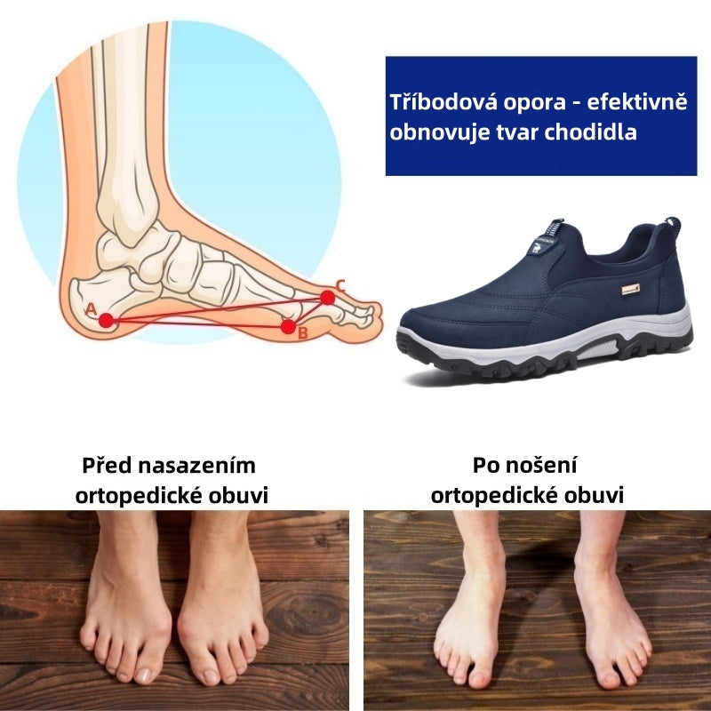 Poslední den! Sleva 70 %! ✅ Ortopedická zdravotní obuv určená speciálně pro lidi s problémy s nohama k úlevě od bolesti zad, kloubů a chodidel.