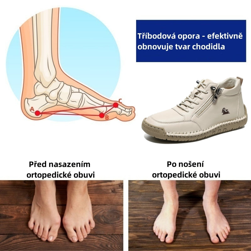 Poslední den! Sleva 30 %! ✅ Ortopedická zdravotní obuv navržená speciálně pro lidi s problémy s nohama – ulevuje od bolesti zad, kloubů a chodidel.