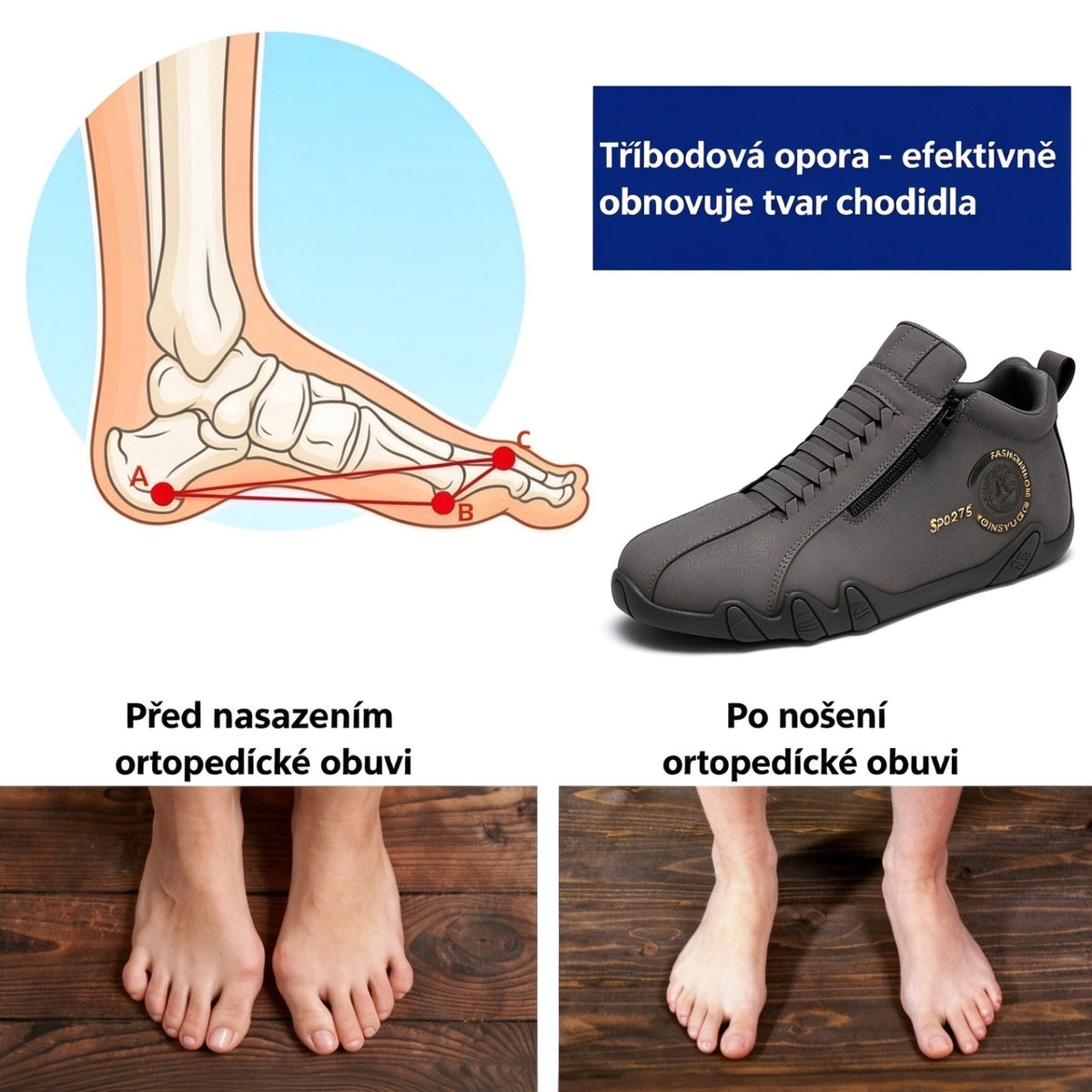 Poslední den! Sleva 70 %! ✅ Ortopedická zdravotní obuv určená speciálně pro lidi s problémy s nohama k úlevě od bolesti zad, kloubů a chodidel.