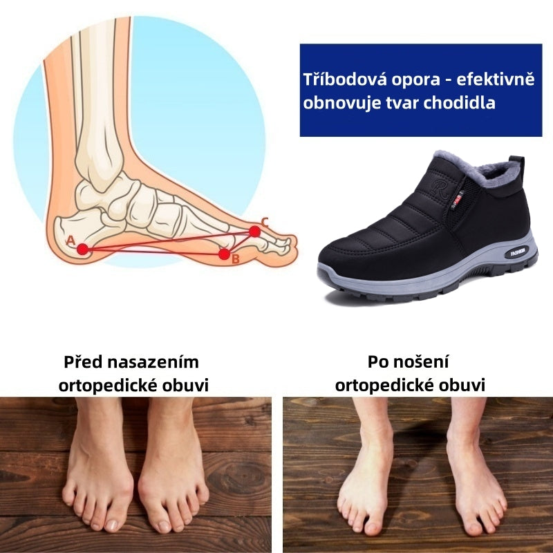 🎉Dnešní speciální nabídka: sleva 30 % – Nenechte si ji ujít! ⏰Ergonomické zimní ortopedické boty pro úlevu od bolesti nohou, kolen a zad – unisex