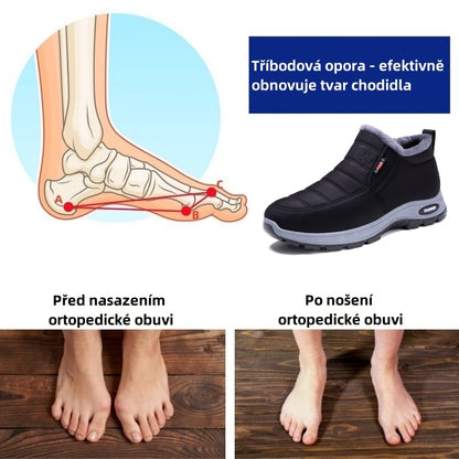 🎉Dnešní speciální nabídka: sleva 30 % – Nenechte si ji ujít! ⏰Ergonomické zimní ortopedické boty pro úlevu od bolesti nohou, kolen a zad – unisex